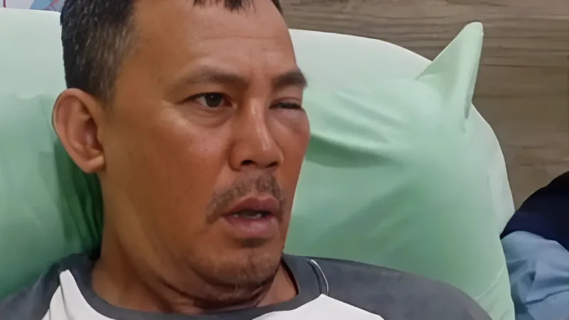 Driver ojol Pontianak hidung patah dipukul oknum TNI di Jalan Perum 4, Panglima Aim, Pontianak Timur, Sabtu (20/9/2025) sore. Korban bernama Teguh kini masih menjalani perawatan intensif di Rumah Sakit Medika Djaya. - foto courtesy Kalbar Online